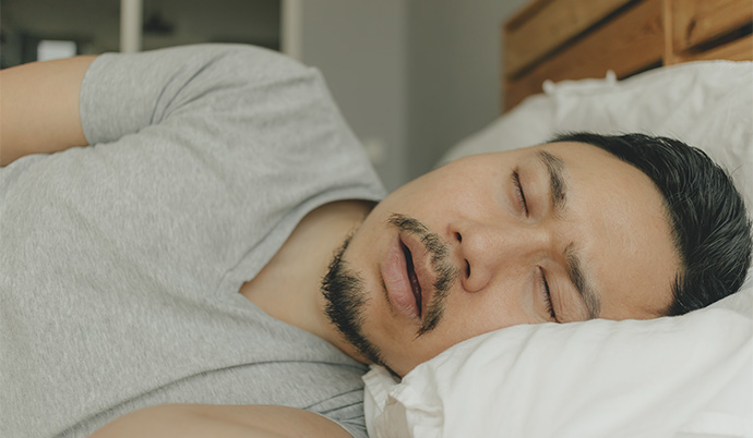 Homem com apneia do sono dormindo de boca aberta.