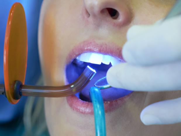 Clareamento dental