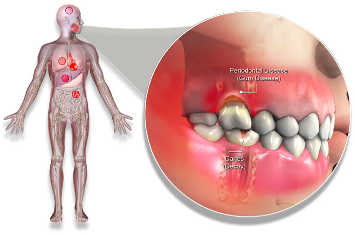 medicina periodontal organismo