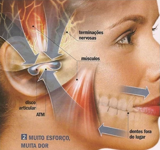 Barulhos no ouvido? Pode ser a Articulação temporomandibular – Dr