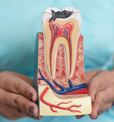 Exemplo de como são os dentes vistos por dentro