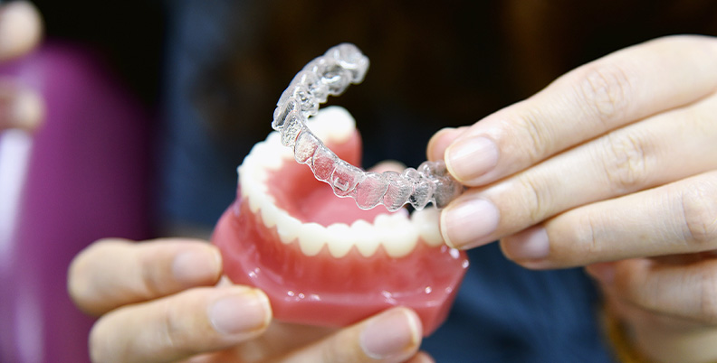 dentista colocando aparelho Invisalign em molde